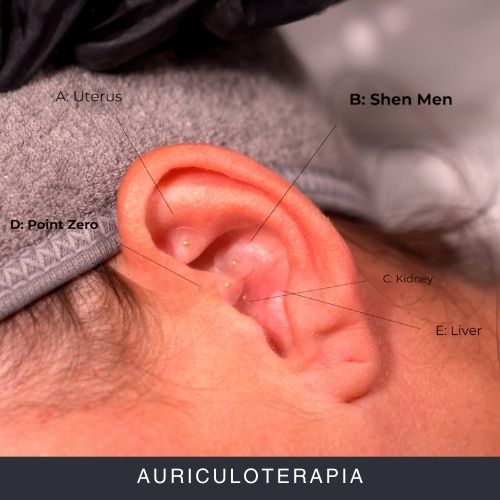 Auriculoterapia Curs Online Auriculoterapia Curs Online