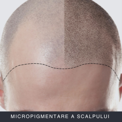 Micropigmentare a Scalpului Curs Online Micropigmentare a Scalpului Curs Online