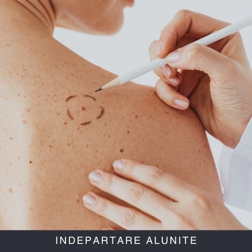 Indepartare alunite Curs Online Indepartare alunite Curs Online