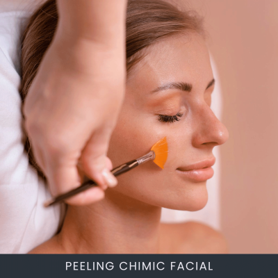 Tratament Peeling Chimic Facial
