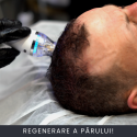 Regenerare a Părului Curs Online Regenerare a Părului Curs Online