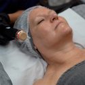 Curs de Tratament Facial Oxybrasion Online Curs de Tratament Facial Oxybrasion Online